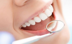 Teeth cleaning and lime removal for 69 SR