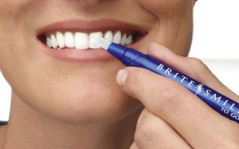 40% discount on dental bleaching